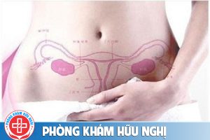 Bạn dễ bị vô sinh nếu mắc bệnh viêm cổ tử cung