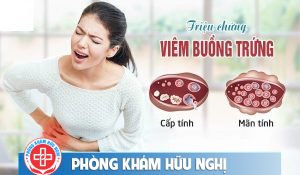 Viêm buồng trứng kẻ thù của sức khỏe sinh sản nữ giới