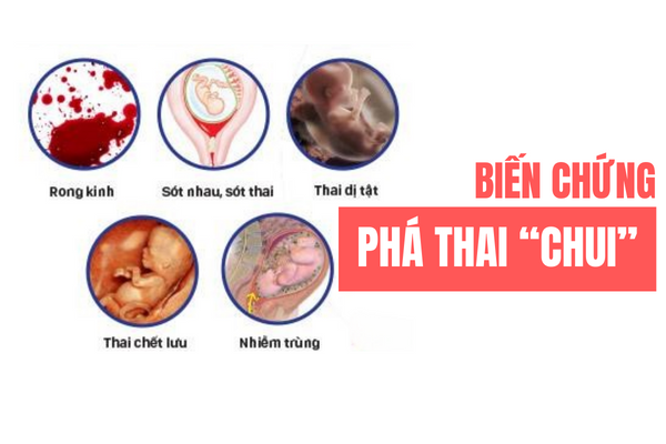 benh-vien-pha-thai-an-toan-kin-dao-va-ve-trong-ngay-01