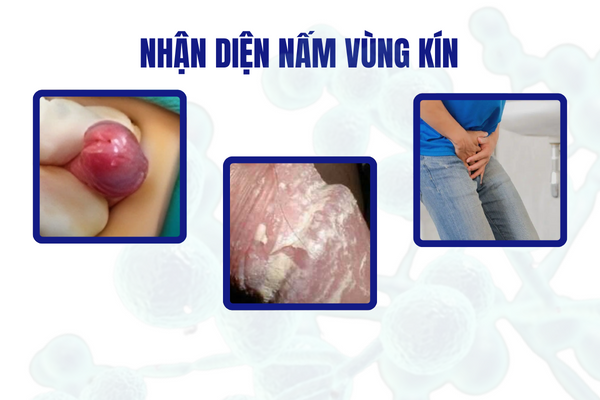 nam-duong-vat-thong-tin-nhan-biet-va-chua-tri-hieu-qua-2